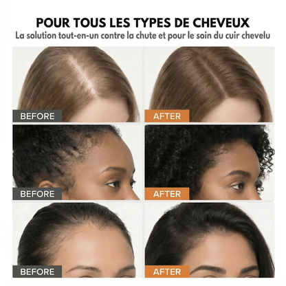 Le Sérum Coréen N°1 pour la Repousse