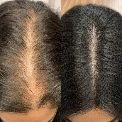 Shampoing Coréen Revitalisant